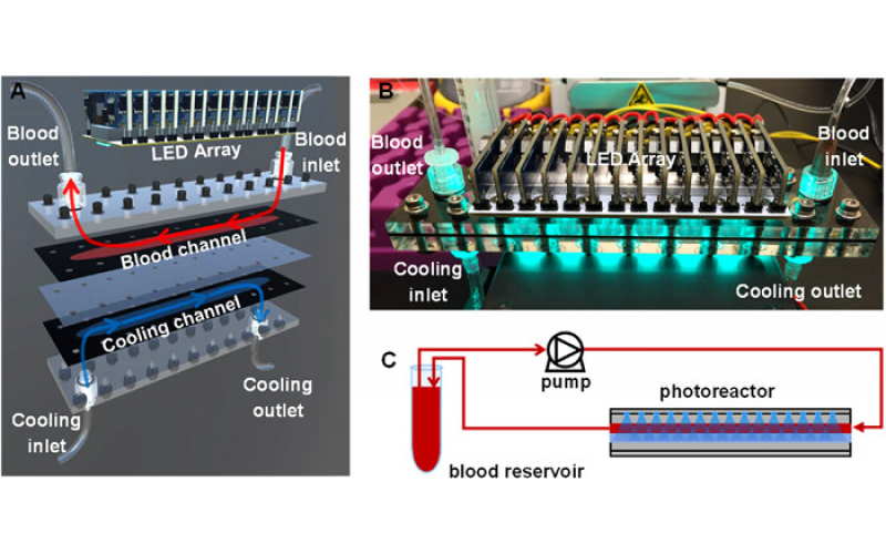 微流控光反应器治疗新生儿黄疸